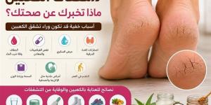 7 رسائل صحية يكشفها تشقق الكعبين لا تتجاهليها - المدينة برس