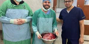 فريق طبي بجامعة أسيوط ينجح في استئصال ورم مبيضي ضخم لسيدة خمسينية - المدينة برس
