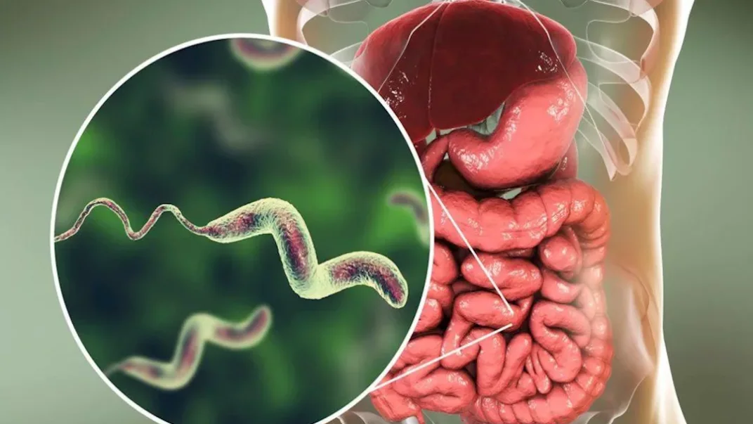 جرثومة المعدة لا تستجيب للعلاج.. 5 أخطاء قد تقلل فرص الشفاء