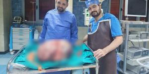 فريق طبي بجامعة المنيا يستأصل ورما يزن 24 كيلو جراما من مبيض سيدة - المدينة برس