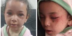 شغلت الأغاني وهي بتقتلها، حكاية الطفلة بسملة التي عادت من الموت بالمنيا - المدينة برس