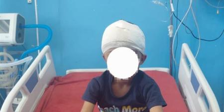 معجزة طبية في سوهاج.. استخراج رصاصة من مخ طفل وإنقاذه دون مضاعفات - المدينة برس