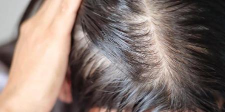 ماء البصل والكركدية لشعر طويل وكثيف وأكثر قوة - المدينة برس