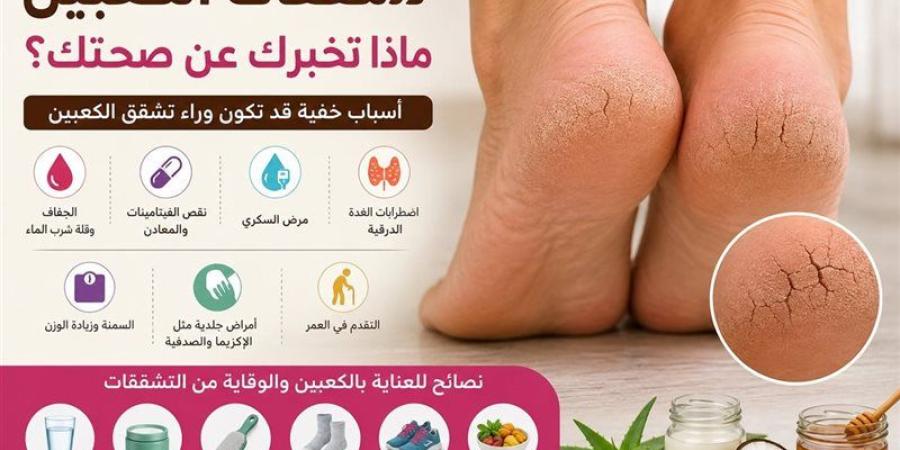 7 رسائل صحية يكشفها تشقق الكعبين لا تتجاهليها - المدينة برس