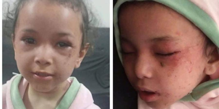 شغلت الأغاني وهي بتقتلها، حكاية الطفلة بسملة التي عادت من الموت بالمنيا - المدينة برس