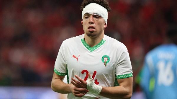 سطو مسلح على منزل المغربي نيل العيناوي لاعب روما في إيطاليا